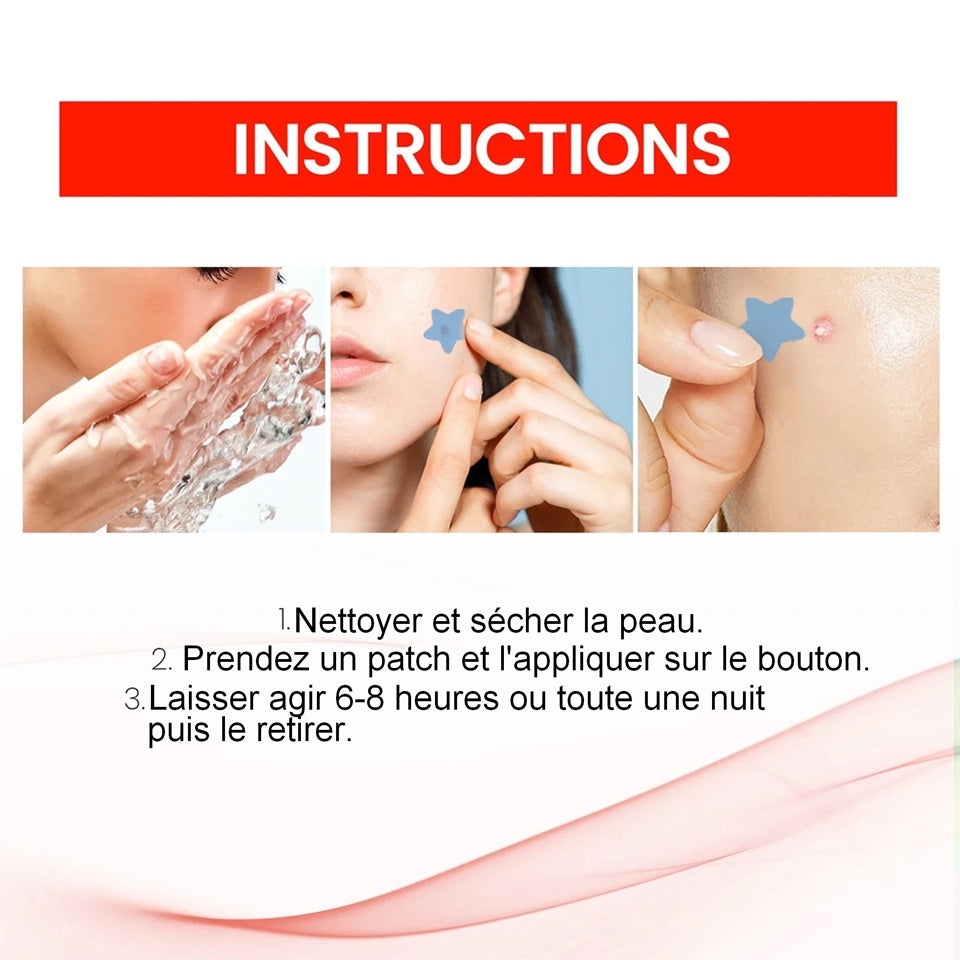Patchs anti-Acné en Forme d'Étoiles